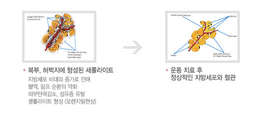 다이어트 운동