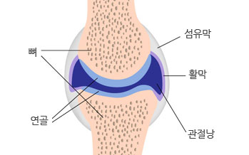 무릎구조