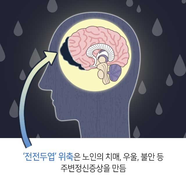 치매와 총명음 총명탕 5