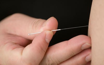 통증클리닉 시술 요법 2