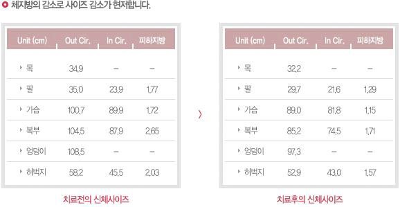 비만클리닉 체질DIET 효과 3