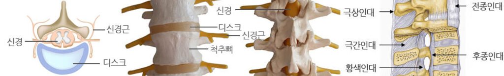 통증클리닉 척추질환