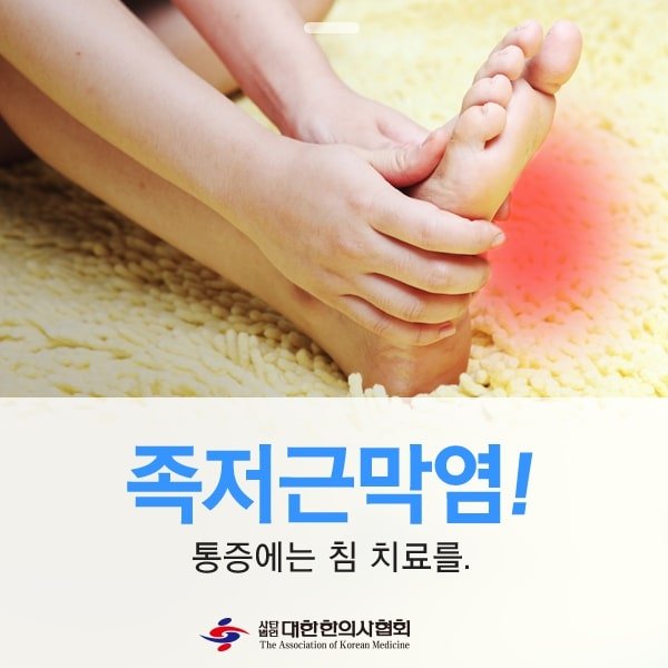 족저 근막염 침치료 1