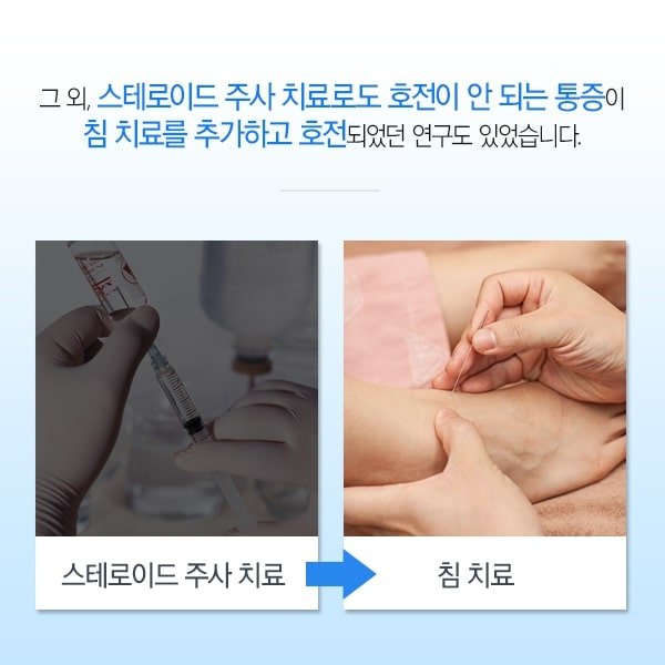 족저 근막염 침치료 10
