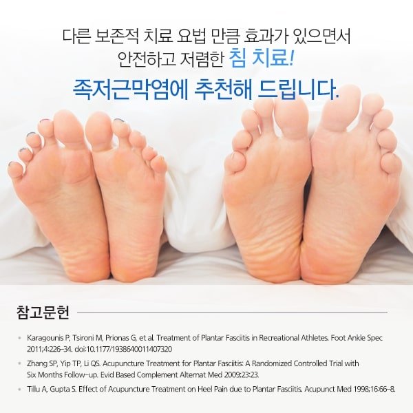 족저 근막염 침치료 12