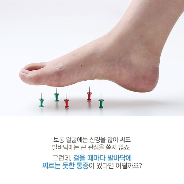 족저 근막염 침치료 2