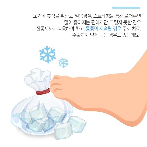 족저 근막염 침치료 5