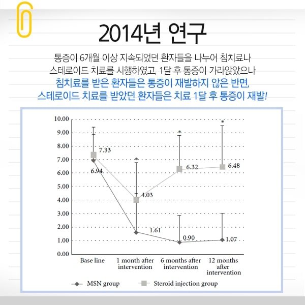 족저 근막염 침치료 9