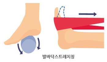 통증클리닉 발바닥 근막염 2