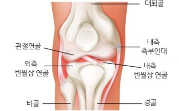 통증클리닉  무릎 질환 2