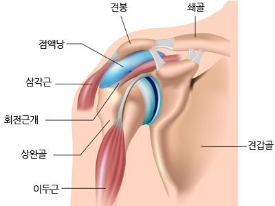 통증클리닉  어깨 질환