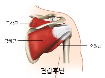 통증클리닉  어깨 질환 2