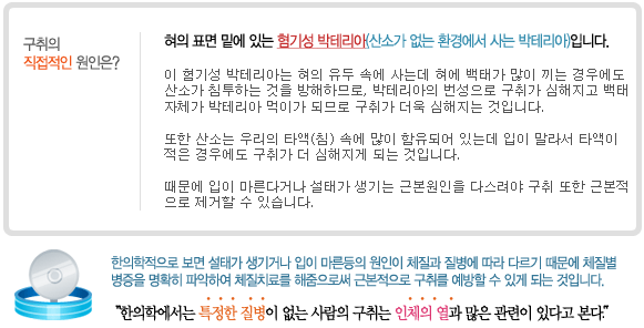 구취클리닉 구취 치료 가능한가? 4