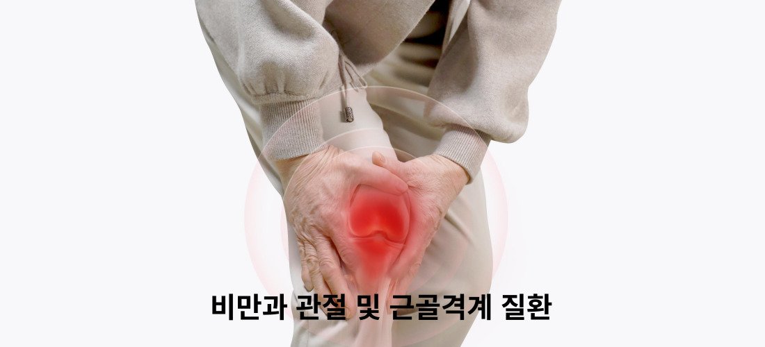비만과 질병과의 관계에 대해서 4