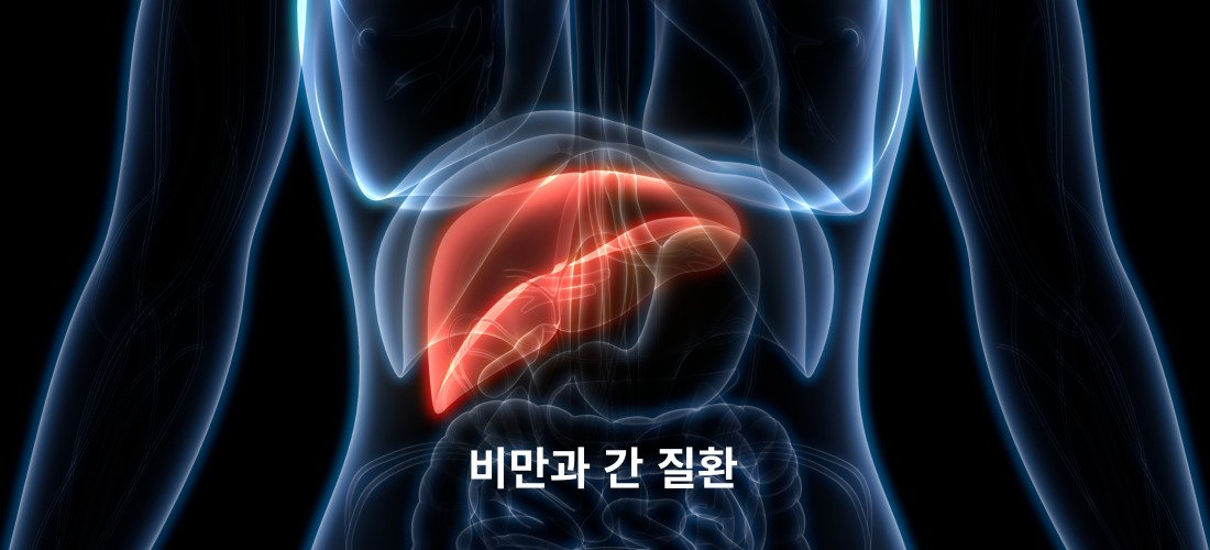 비만과 질병과의 관계에 대해서 6