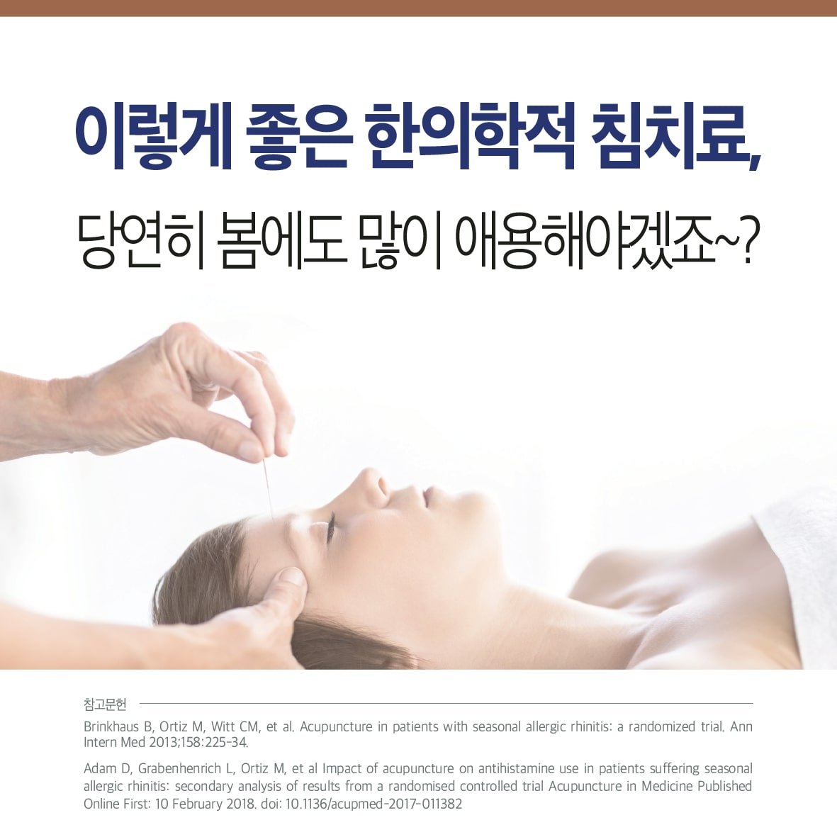 침 치료로 알레르기 비염 환자의 항히스타민제 사용을 감소 시킨다. 9