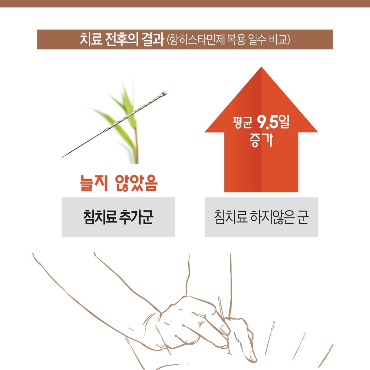 침 치료로 알레르기 비염 환자의 항히스타민제 사용을 감소 시킨다. 7